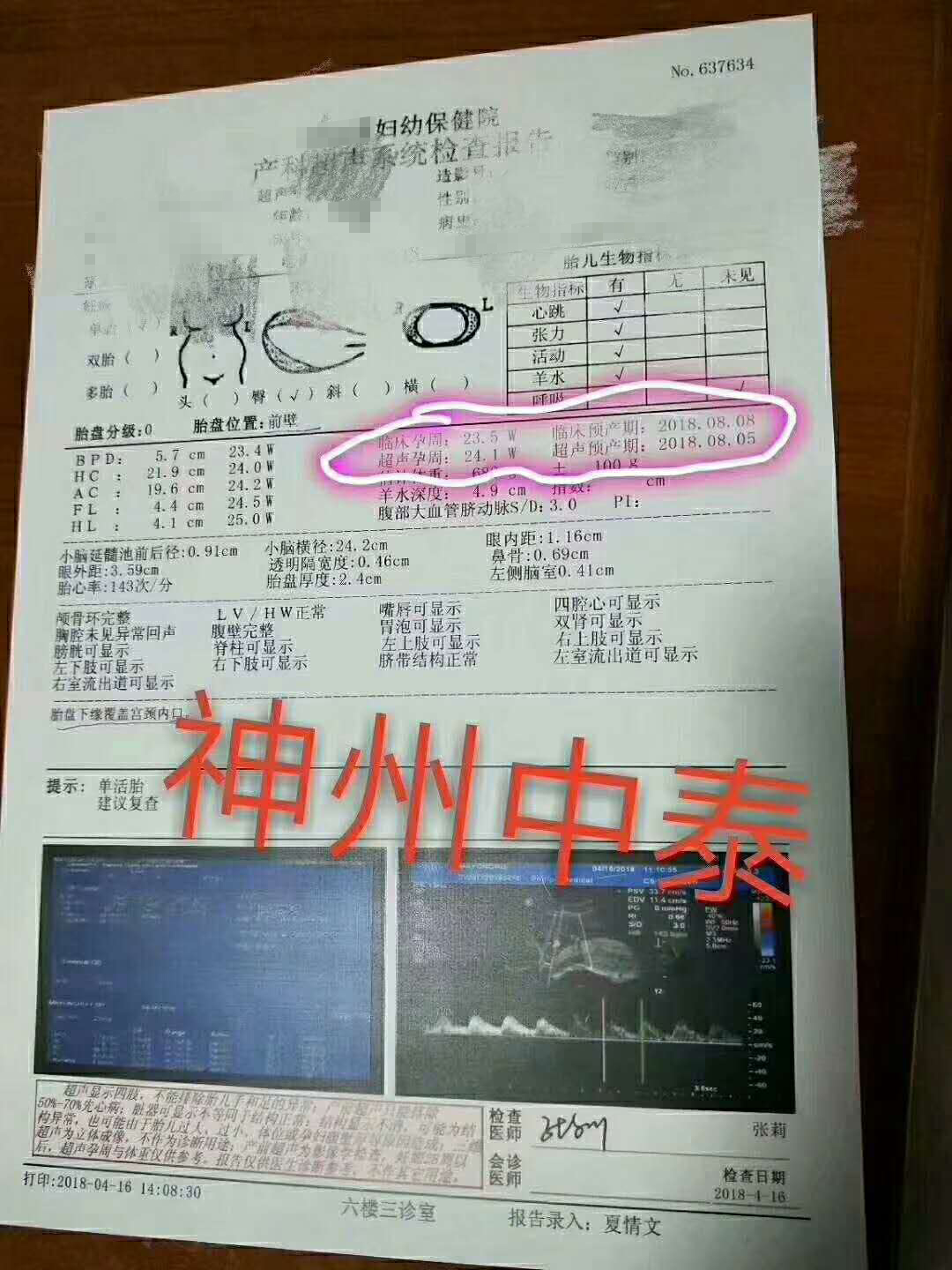 1524562719772637.jpg